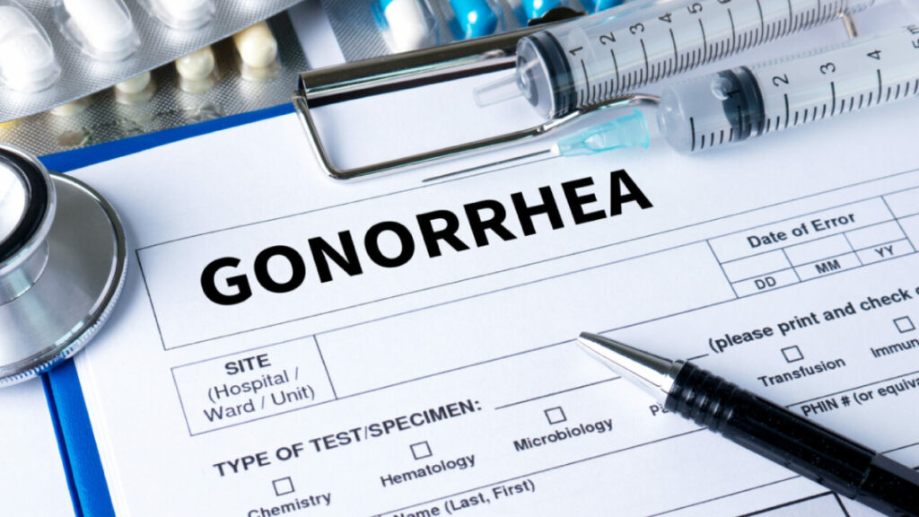 Complications of Untreated Gonorrhea