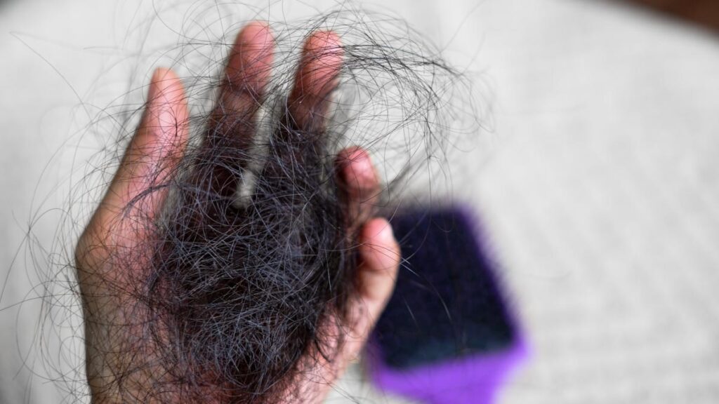 Is Your Hair Falling Off? Not Eating Right Might Be The Cause