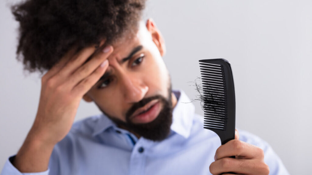 Five Autoimmune Diseases That Cause Hair Loss