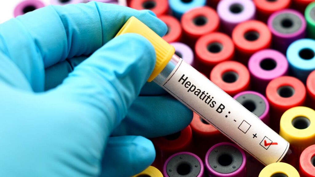 Hepatitis B: Causes, Symptoms, And How To Protect Yourself