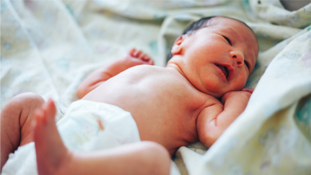 Signs That Tell Your Baby Has Jaundice