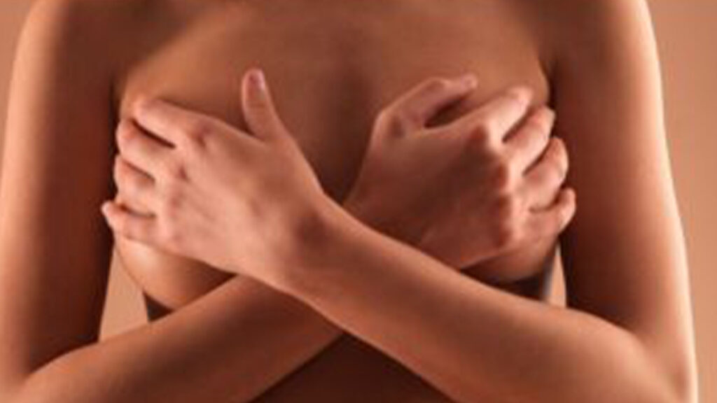 Breast Rash: Symptoms, Causes, Risk Factors, Prevention