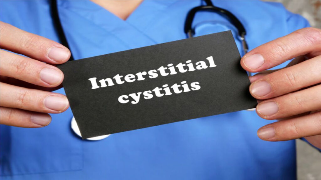 Interstitial Cystitis: Things You Can Do To Help