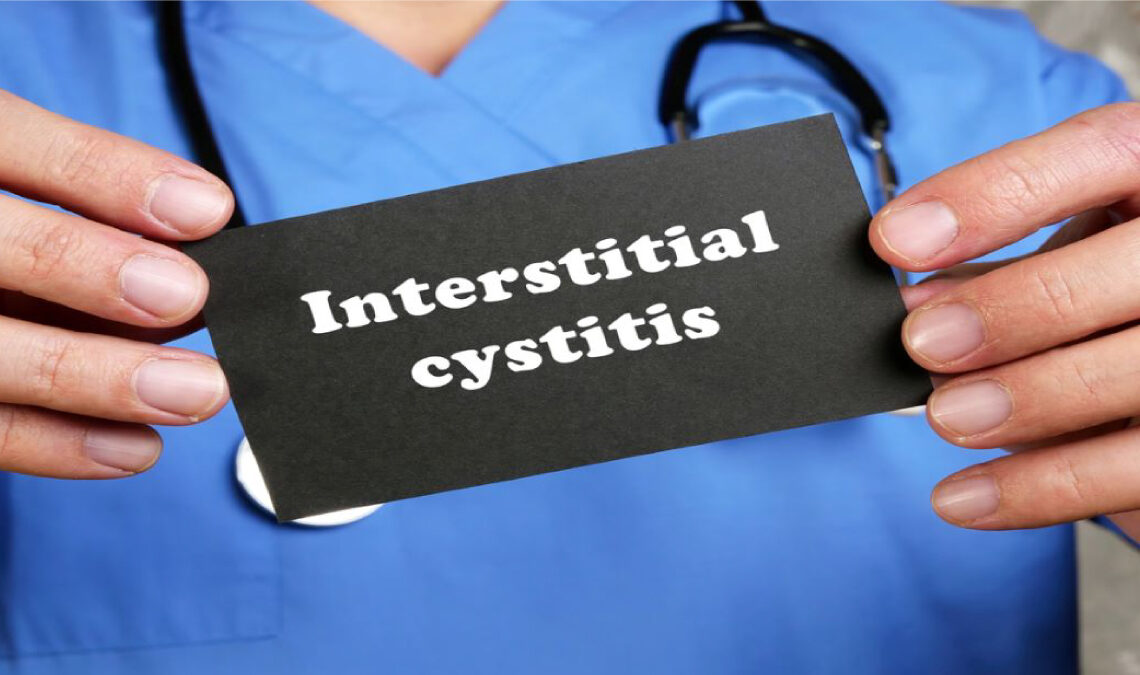 interstitial-cystitis-things-you-can-do-to-help-doctall-living