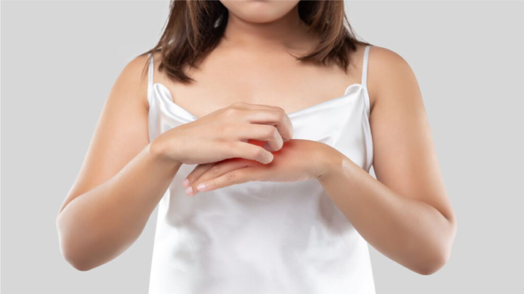 The Difference Between Ringworm And Eczema