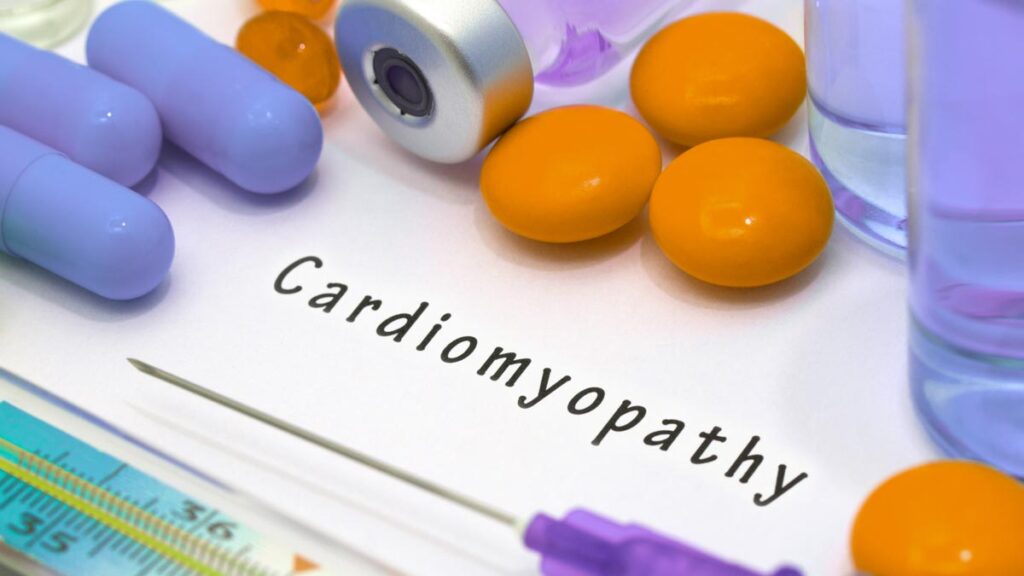 Difference Between Dilated And Hypertrophic Cardiomyopathy