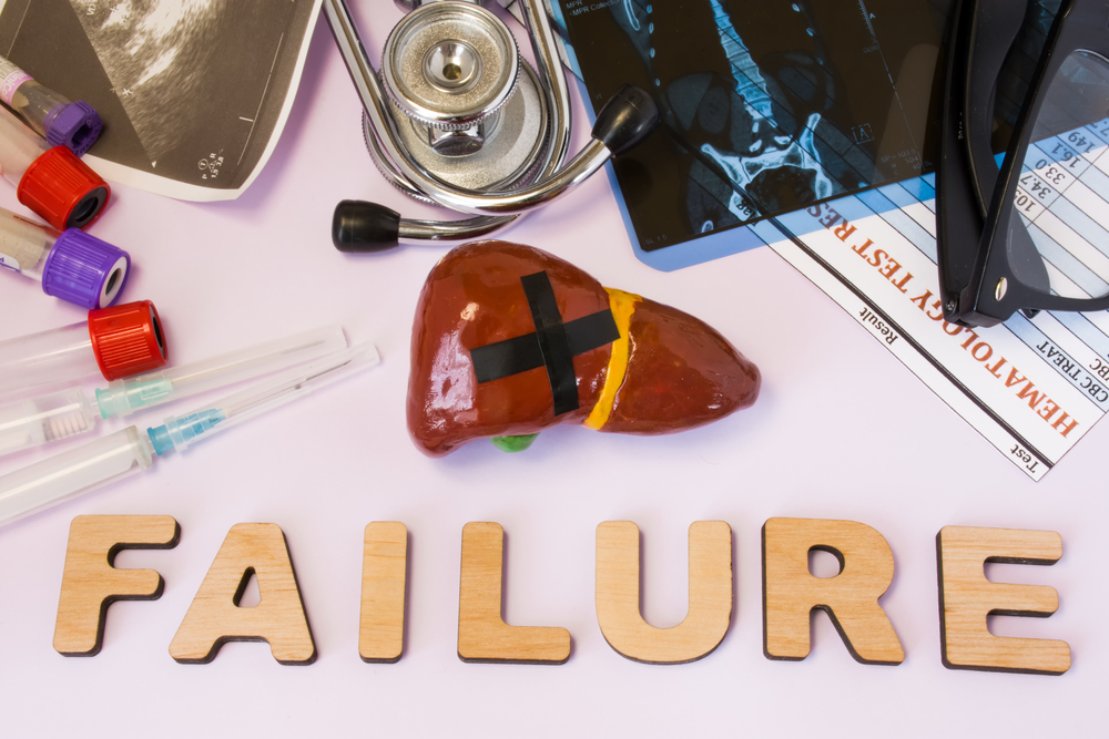 Acute Liver Failure