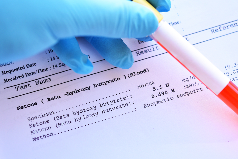 Diabetes Ketoacidosis