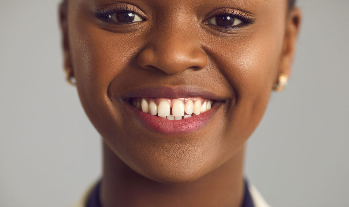 Diastema: What You Need To Know – Doctall Living