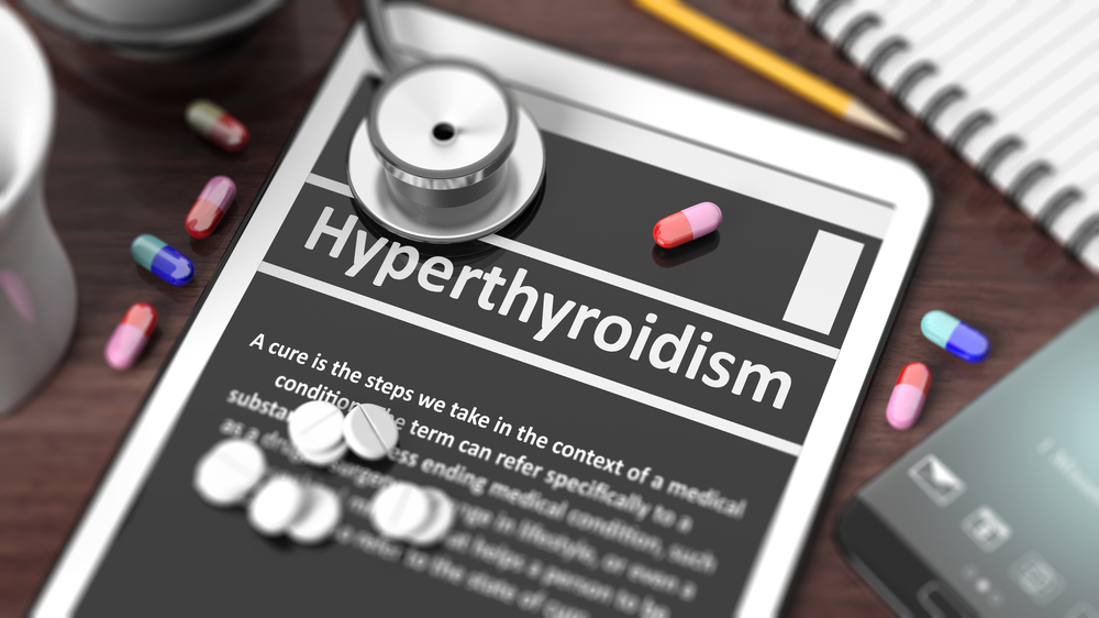 Hyperthyroidism