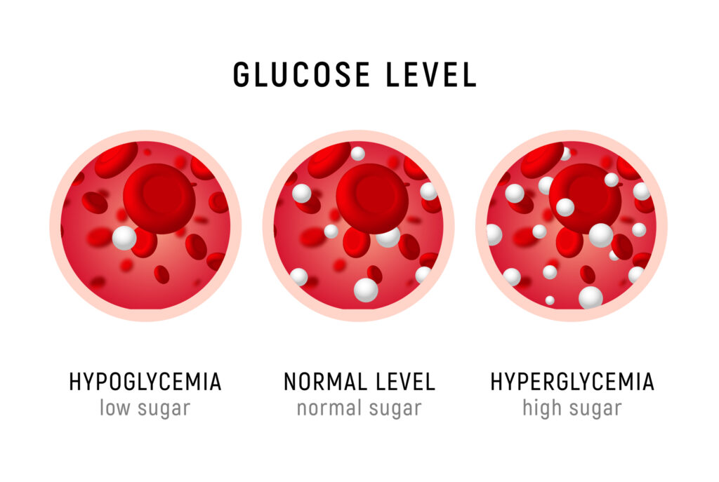 Hypoglycemia