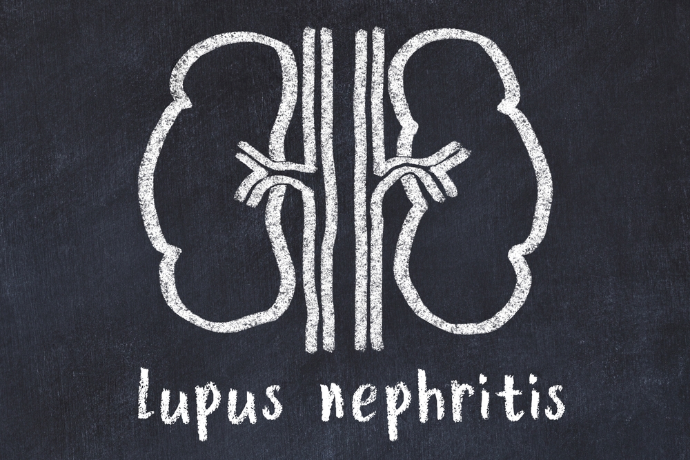 Lupus Nephritis