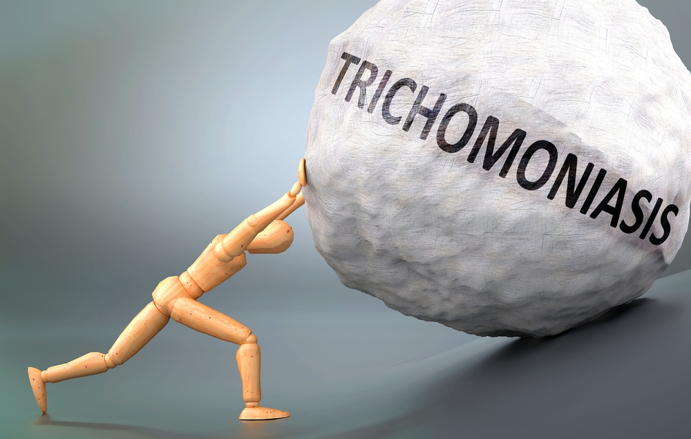 Trichomoniasis