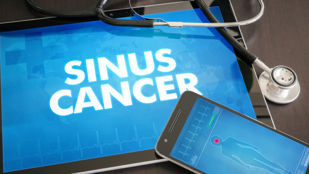 Sinus Cancer: Causes, Symptoms, and Treatment 