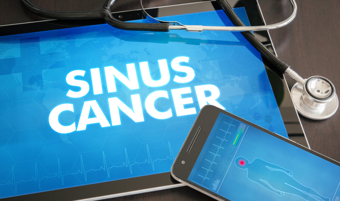 Sinus Cancer Causes Symptoms And Treatment Doctall Living