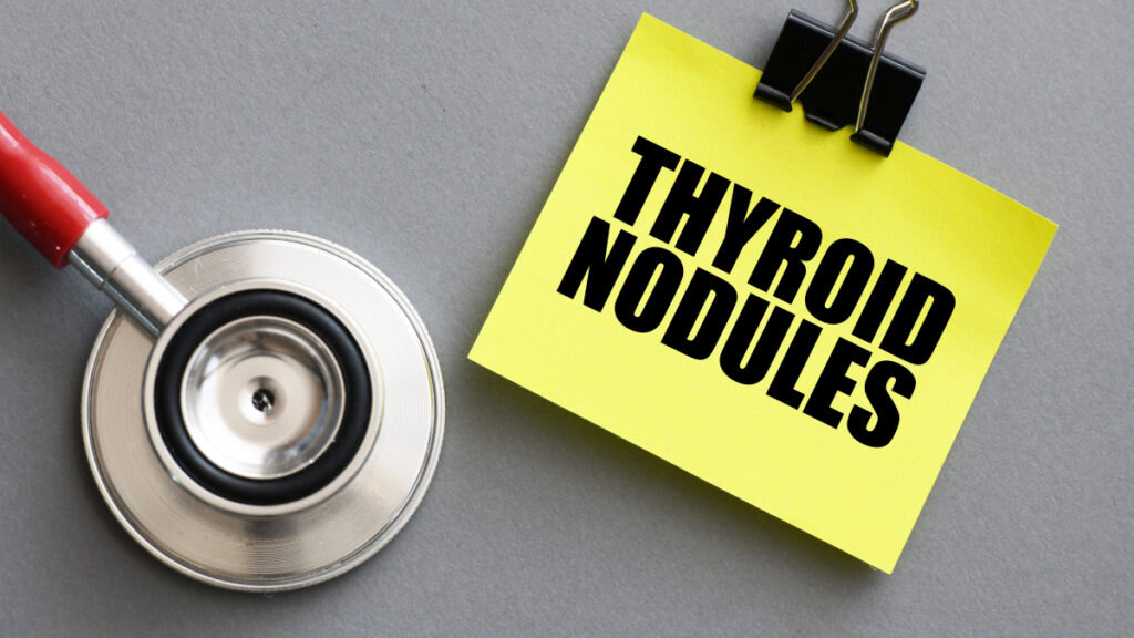 Thyroid Nodules Doctall Living