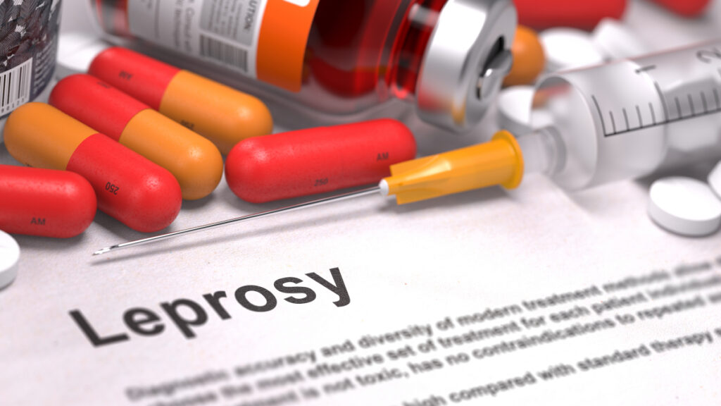 Eradication of Leprosy Should Be Prioritised - Nigeria Medical Association